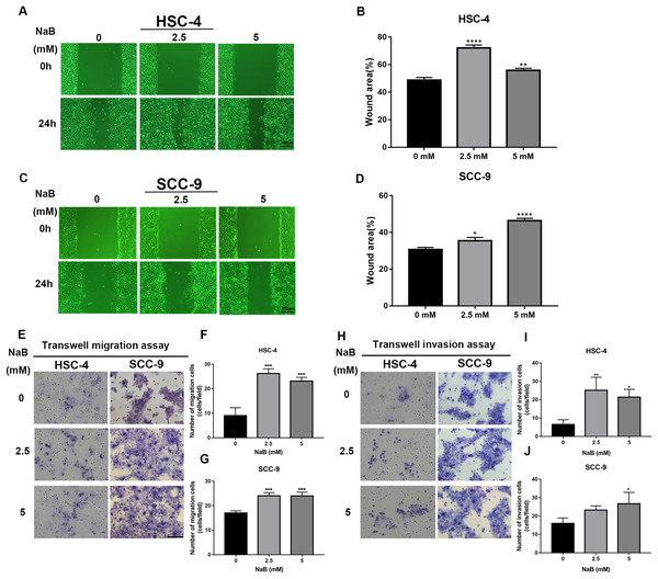 The promoting effect of NaB on OSCC cells migration and invasion.