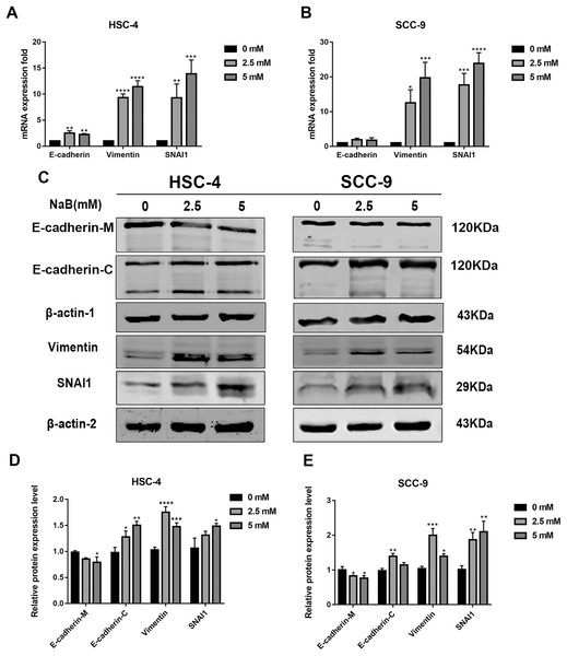 NaB promotes the expression of mesenchymal markers and increases internalization of E-cadherin into the cytosol.