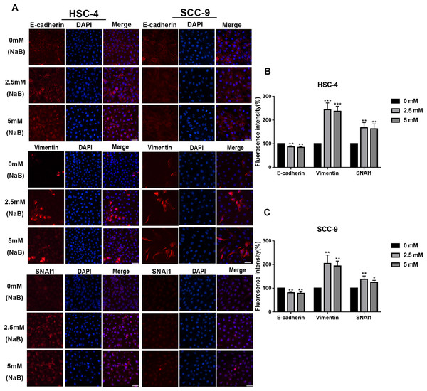 Immunofluorescence of mesenchymal markers.