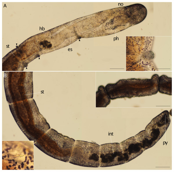 Ctenodrilus japonicus sp. nov. (NSMT-Pol H-847) (A) anterior end, inlet showed a scar; (B) posterior end, left inlet showed a neurochaeta, right inlet showed the middle body of paratype.