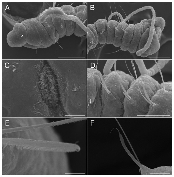 Scanning electron micrographs of Raphidrilus misakiensis sp. nov. (NSMT-Pol P-850) (A) anterior end; (B) anterior end of another specimen; (C) nuchal organ; (D) chaetigers 1–3; (E) neurochaetae of anterior segment; (F) neurochaetae of posterior segment.