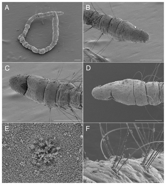 Scanning electron micrographs of Raphidrilus okinawaensis sp. nov. (NSMT-Pol P-852) (A) whole body; (B) anterior end of another specimen, dorsal view; (C) anterior end, ventral view; (D) anterior end, lateral view; (E) nuchal organ; (F) noto- and neurochaetae of middle segment.