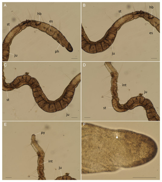 Raphidrilus okinawaensis sp. nov. (NSMT-Pol H-851) (A) anterior end; (B–D) middle segments; (E) posterior end; (F) enlarged view of anterior end.