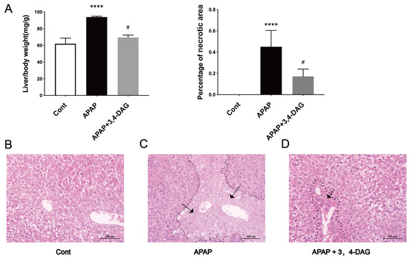 Effects of DAG on relative organ weight and liver histopathological (A) Effects of DAG on relative organ weight (n = 5 per group, df = 4, ****p < 0.0001, #p < 0.0001). APAP compared with control; DAG compared with APAP. (B–D) Liver tissue sections stained with hematoxylin.