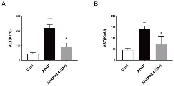 Effect of DAG on activities of plasma ALT (A) and AST (B) in APAP-treated mice.