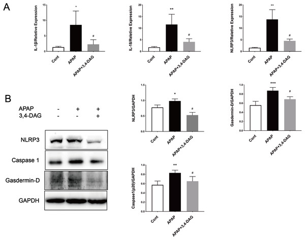 Effects of DAG on inflammatory factors and treatment on NLRP3, Gasdermin-D, Caspase1 (p20) activation in the liver tissues were determined 24 h after APAP-treated mice.