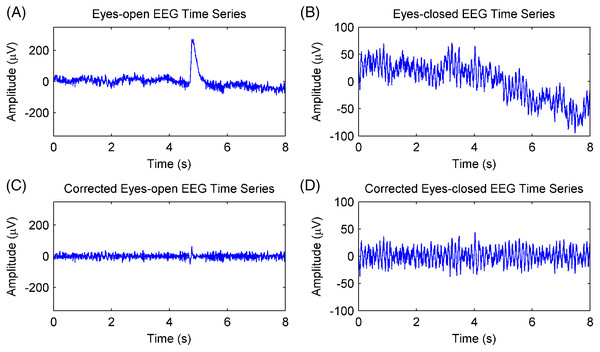 Artifacts removal of EEG signals.