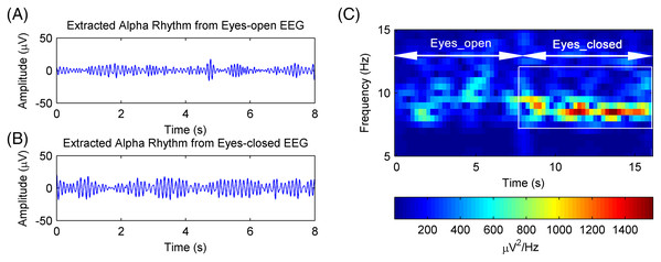 The extracted alpha rhythms of real EEG signals.