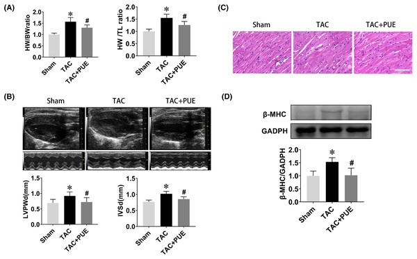 Puerarin decreased the cardiac hypertrophy induced by TAC in mice.