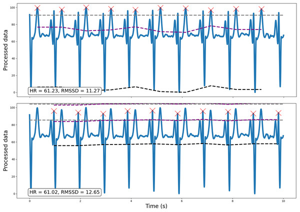Example of how the implementation of traditional amplitude-based analyses may be insufficient for peak detection, particularly for atypical ECG signals.