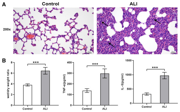 ALI induced histological changes, and ALI exosomes were involved in the inflammatory response.