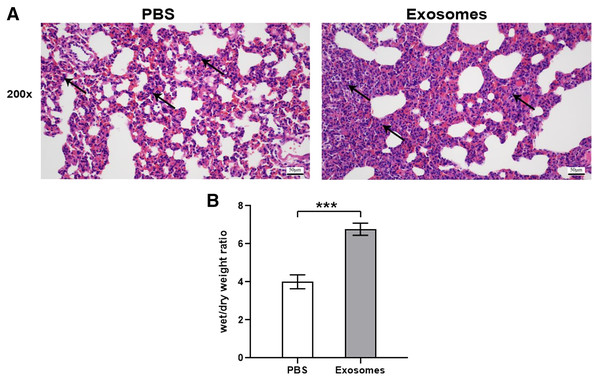 Histological examination and wet/dry weight ratio of lung tissues of rats injected with ALI exosomes or PBS.
