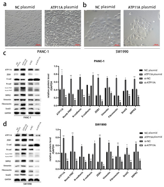 ATP11A promotes EMT of PANC-1 and SW1990 cells.