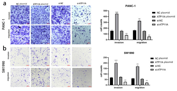 ATP11A affects the invasion and migration ability of pancreatic cancer cells.