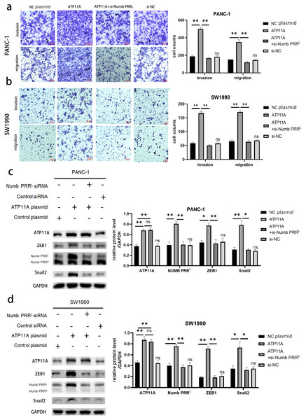 Rescue experiments. ATP11A affects the expression of ZEB1/Snail2 and the invasion and migration ability of pancreatic cancer cells by regulating Numb PRRL.