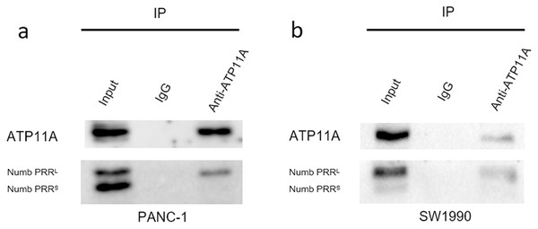 The close interaction between Numb and ATP11A in PC cell lines.