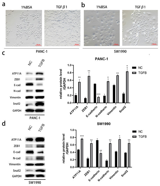 The promoting effect of ATP11A on EMT is TGFB dependent.