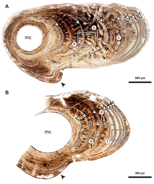 Median fin bone palaeohistology of Miguashaia bureaui (MHNM 06-1238).