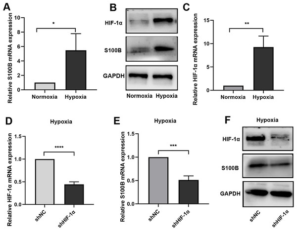 S100B is induced by hypoxia in HepG2.