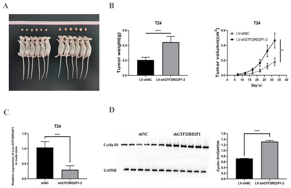Effect of GTF2IRD2P1 on proliferation and cell cycle of BCa cells by in vivo assay.