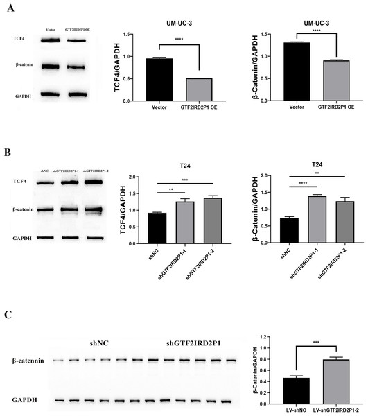The role of GTF2IRD2P1 in the regulation of BCa in the Wnt signaling pathway.