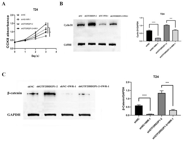Rescue assay: Wnt signaling pathway inhibitor IWR-1 rescues the pro-carcinogenic effect of GTF2IRD2P1 in BCa.