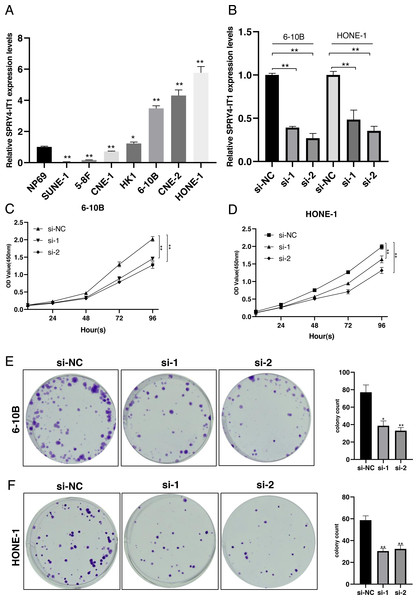 SPRY4-IT1 was up-regulated in several NPC cell lines and knockdown of SPRY4-IT1 inhibited cell proliferation.