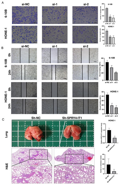 Knockdown of SPRY4-IT1 inhibited the NPC cell migration in vitro and metastasis in vivo.