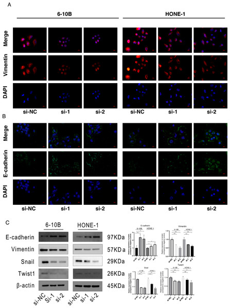 Knockdown of SPRY4-IT1 affected EMT-related proteins expression.