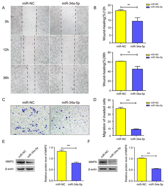 miR-34a-5p inhibited the cell migration in SK-RG cells.