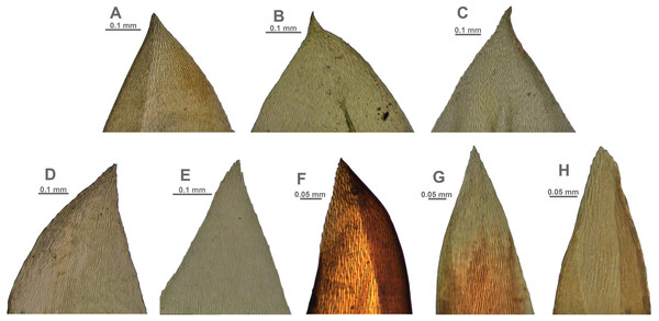 Stem leaf tips in plants from the revealed lineages of subaquatic Pseudohygrohypnum.