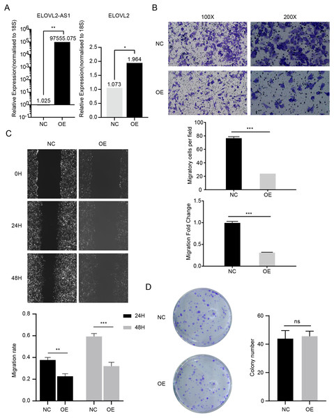 ELOVL2-AS1 overexpression can affect ELOVL2 expression and BRCA cell migration.