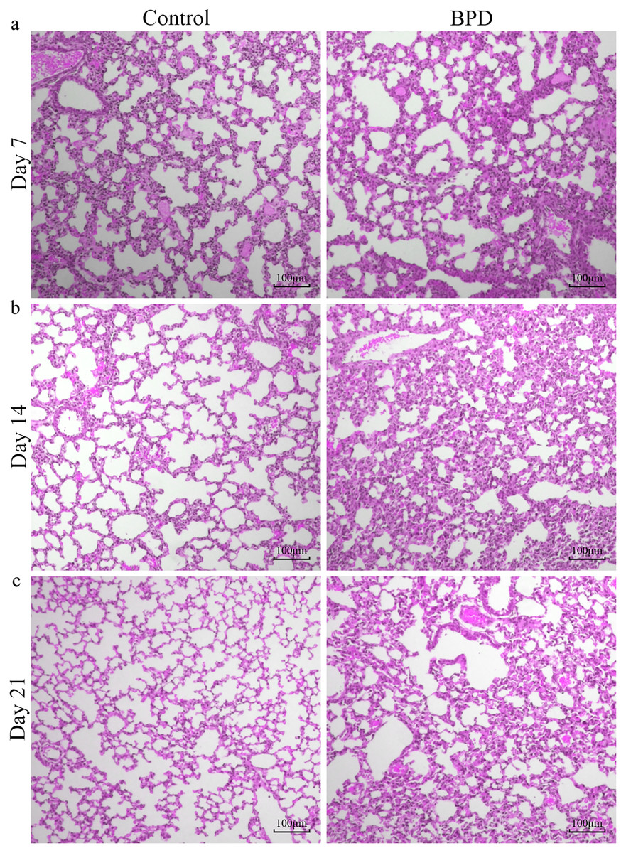 Change of intestinal microbiota in mice model of bronchopulmonary 