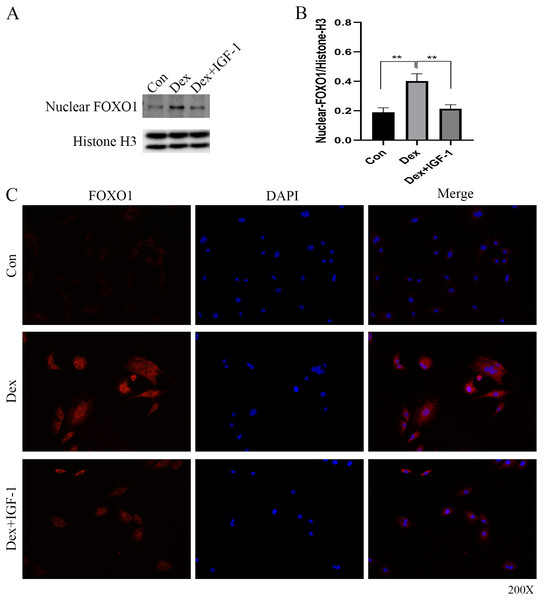  Immunofluorescence studies showing the nuclear translocation of FOXO1.