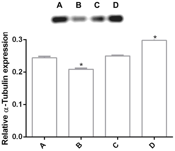 Alteration of α-tubulin expression in G. lamblia trophozoites by pomegranate peel extract.