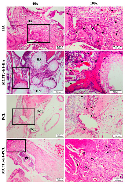 Histological analysis on rat’s maxillary bone defect after six weeks of transplantation.
