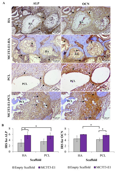 Immunohistochemistry analysis on rat’s maxillary bone defect after six weeks of transplantation.