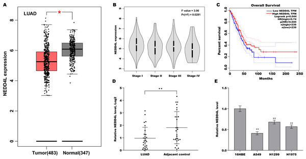 Downregulated NEDD4L was correlated with poor prognosis in LUAD.