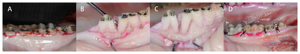 Crown lengthening surgery is demonstrated and conducted on the prepared pig mandible models.