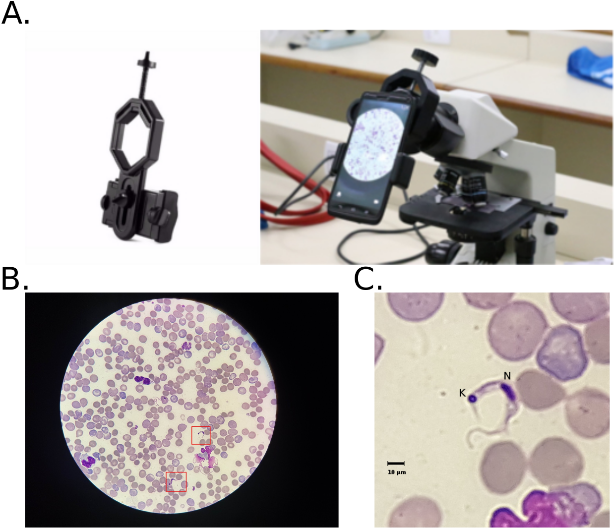 Automatic detection of the parasite Trypanosoma cruzi in blood
