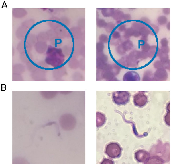 Sample images of false-positive and false-negative Chagas parasite detection algorithm.