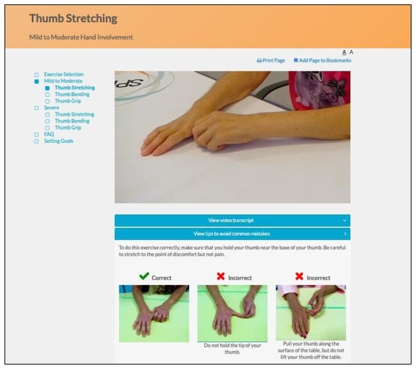 Instructional video of hand exercise and illustration of common mistakes.