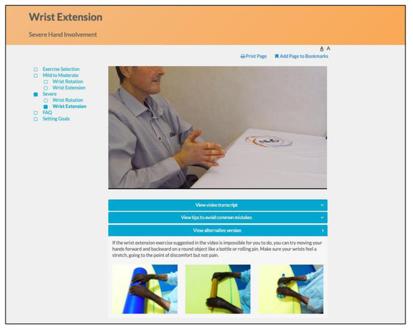 Pictures illustrating alternate versions on how to perform the exercise for patients with very severe hand involvement.