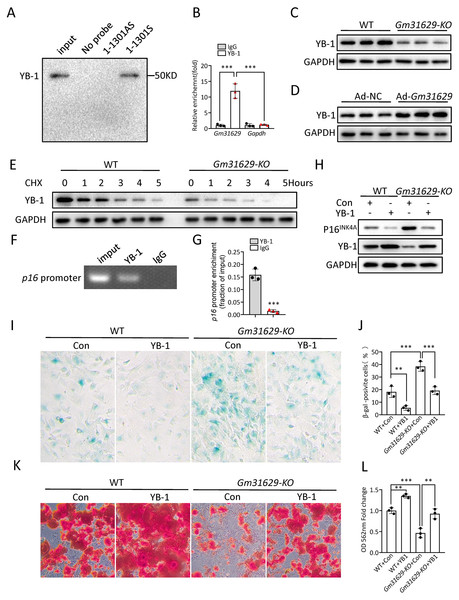 Gm31629 regulates BMSCs senescence through YB-1/P16INK4A pathway.