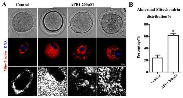 Effects of AFB1 on the mitochondria distribution in mouse oocytes.
