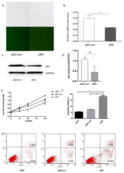 The expression levels of thep62 gene and protein in U937 cells were successfully reduced compared with controls after LV-SQSTM1-RNAi treatment.