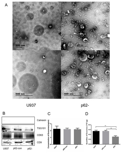 The exosome forms by electron microscopy after ultracentrifugation.