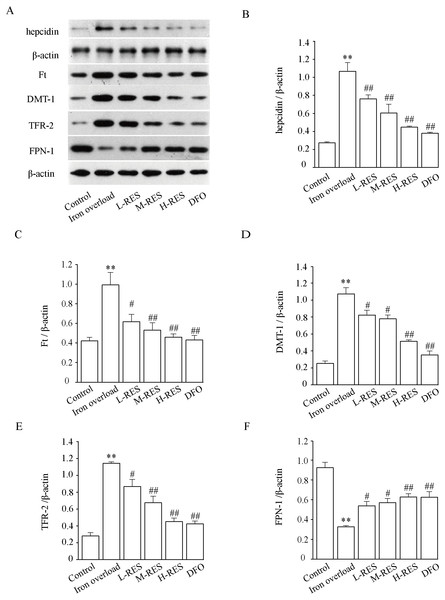 Effects of RES on hepcidin (B), Ft (C), DMT-1 (D), TFR-2 (E) and FPN-1 (F) in iron-overload mice.