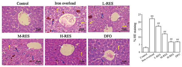 Effects of RES on pathologic changes of liver were visualized by H&E staining.