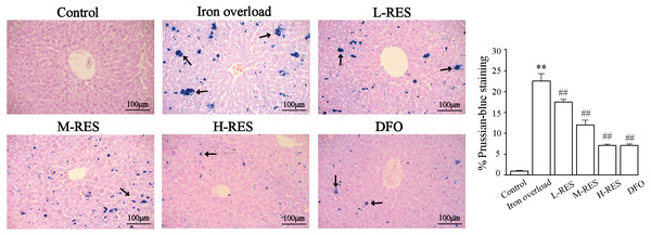 Effects of RES on liver iron deposition were visualized by Prussian blue staining.